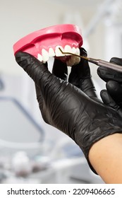 Close-up View Of The Dentist's Hands In Latex Gloves With The Layout Of A Human Jaw And A Dental Restoration Instrument. Dental Office On The Background. Medical Tools Concept.