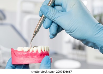 Close-up View Of Dentist's Hands In Latex Gloves With A Layout Of The Human Jaw And A Universal Curette. Dental Office On The Background. Medical Tools Concept.