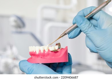 Close-up View Of Dentist's Hands In Latex Gloves With A Layout Of The Human Jaw And The Dental Restoration Instrument. Dental Office On The Background. Medical Tools Concept.