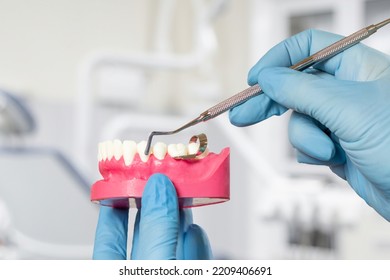 Close-up View Of Dentist's Hands In Latex Gloves With A Layout Of The Human Jaw And A Universal Curette. Dental Office On The Background. Medical Tools Concept.