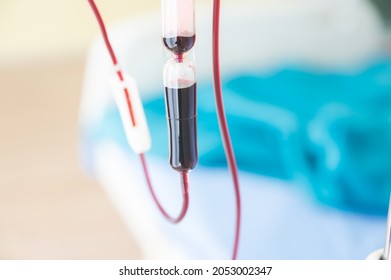 Closeup View Of Drip Chamber For An Intravenous Infusion Set In Hospital For Blood Transfer In Patient Using Equipment And Machine