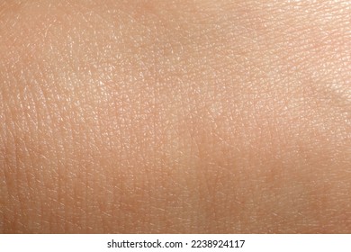 Closeup view of dry human skin as background - Shutterstock ID 2238924117