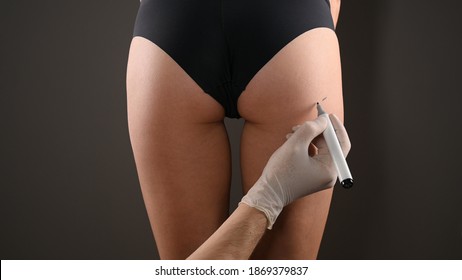 Closeup view of female buttocks marked for plastic operation, on gray background