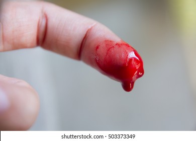 Closeup view of finger on right human hand is cut hurt and bleeding with bright red blood outdoor sunny day on blurred natural background