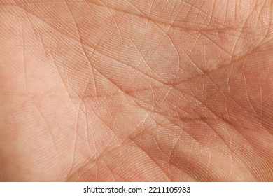 Closeup view of human palm with dry skin - Shutterstock ID 2211105983