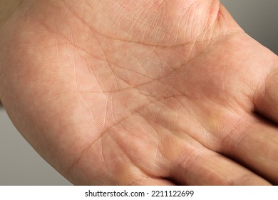 Closeup view of human palm with dry skin - Shutterstock ID 2211122699