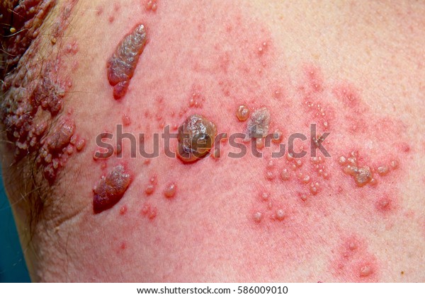 Closeup View Human Skin That Has Stock Photo (Edit Now) 586009010