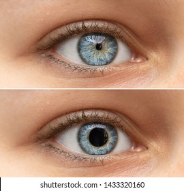 A closeup view on the blue eyes of a pretty young woman. Collage comparing the black pupil, one image shows an enlarged pupil and one shows a reduced pupil. Pupillary light reflex in humans.