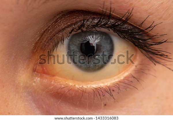 Closeup View On Eye Young Caucasian Stock Photo Edit Now 1433316083