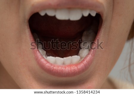 Similar – gap between one’s teeth