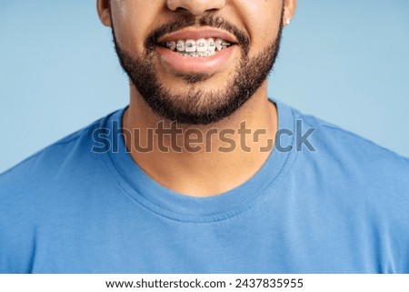 Closeup view of smiling man with dental braces posing isolated on blue background. Health care, orthodontic concept 