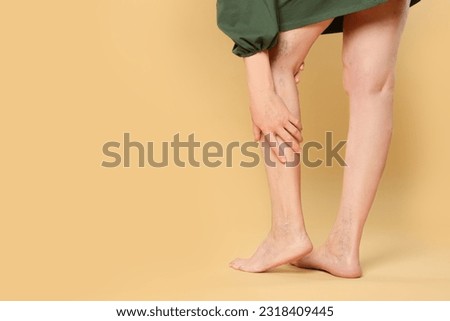 Closeup view of woman suffering from varicose veins on yellow background. Space for text