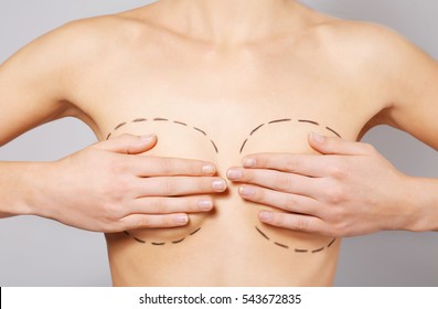 Closeup view of young woman with breasts marked for plastic operation, on light background