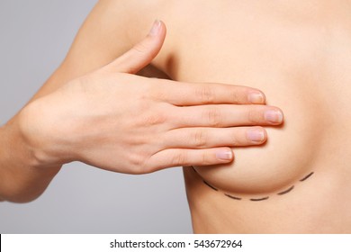 Closeup view of young woman with breasts marked for plastic operation, on light background