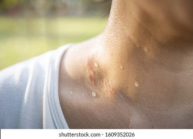 Closeup of wet female throat with water drops or sweat on skin,symptom of panic disorder, lymphoma or obesity, Sweaty asian woman after gym workout or hot weather,sweating, hyperhidrosis concept - Shutterstock ID 1609352026