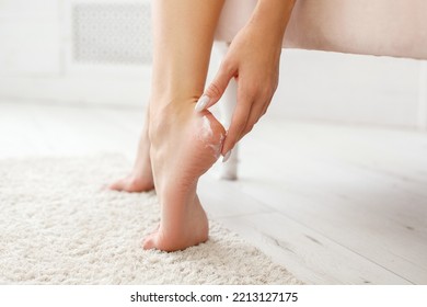 Close-up Woman Applying Cream On Dry Heels