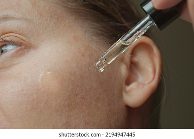 Close-up Of A Woman Applying Serum From An Eyedropper, A Woman In Her Forties And Older.