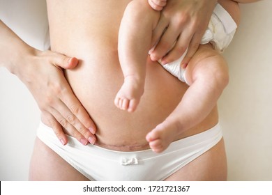 Closeup of woman belly with a scar from a cesarean section. Woman with baby on her hand - Shutterstock ID 1721721367