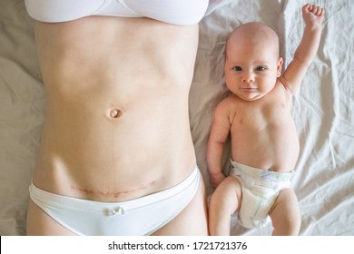 Closeup of woman belly with a scar from a cesarean section and her baby with raised hand near - Shutterstock ID 1721721376