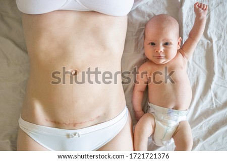 Closeup of woman belly with a scar from a cesarean section and her baby with raised hand near