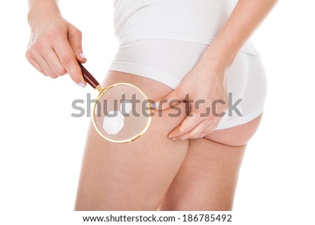 Close-up Of A Woman Checking Cellulite With Magnifying Glass