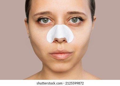 Close-up of a woman with cleaning nose strips from blackheads or black dots on her skin isolated on a beige background. Acne problem, comedones. Enlarged pores on the face. Cosmetology concept