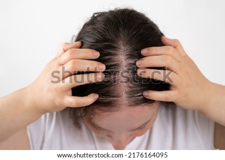 Close-up of woman controls hair loss and little volume with fine hair against a white background because of the sun