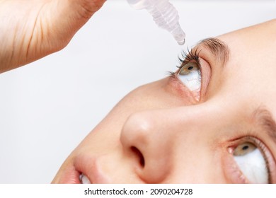 Close-up of woman dripping her eye with medicinal drops natural tear. Disease of retina of eye. Conjunctivitis, keratitis, dry eye syndrome, trauma. Treatment of red inflamed and dilated capillaries