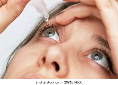 Close-up Of Woman Dripping Her Eyes With Medicinal Drops Natural Tear. Disease Of Eye Retina. Conjunctivitis, Keratitis, Dry Eye Syndrome, Trauma. Treatment Of Red Inflamed And Dilated Capillaries