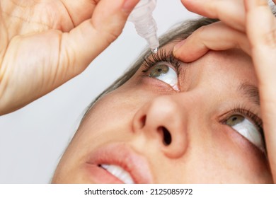 Close-up Of Woman Dripping Her Eyes With Medicinal Drops Natural Tear. Disease Of Eye Retina. Conjunctivitis, Keratitis, Dry Eye Syndrome, Trauma. Treatment Of Red Inflamed Capillaries