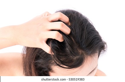 Closeup Woman Hand Itchy Scalp, Hair Care Concept