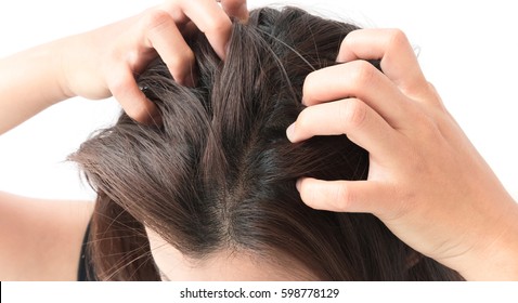 Closeup woman hand itchy scalp, Hair care concept - Shutterstock ID 598778129