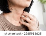 closeup woman hand scratching  itchy skin on her neck caused by allergic to sweat from hot weather 