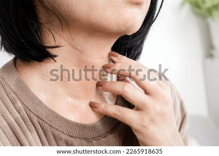 closeup woman hand scratching  itchy skin on her neck caused by allergic to sweat from hot weather 