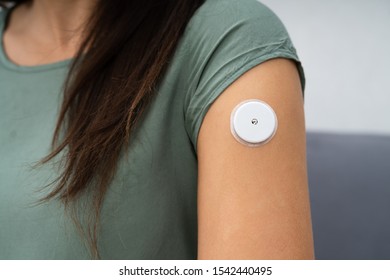 Close-up Of A Woman Testing Glucose Level With A Continuous Glucose Monitor On Her Arm