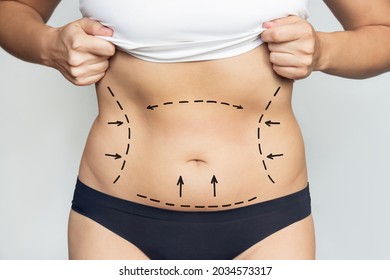 Close-up of a woman's belly with excess fat with marking on her body isolated on a gray background. Liposuction, plastic surgery concept