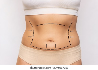 Close-up of a woman's belly with excess fat with marking on her body isolated on a white background. Overweight, flabby and sagging stomach. Liposuction, plastic surgery concept