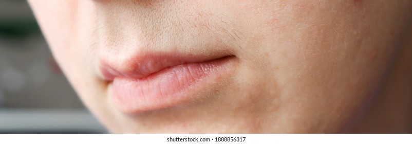 12,989 Facial Hair Woman Acne Images, Stock Photos & Vectors | Shutterstock
