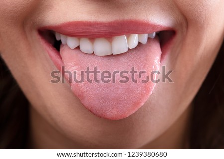 Close-up Of A Woman's Face Showing Her Clean Tongue