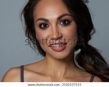 Close-up of woman's lips with fashion bright pink make-up and braces. Beautiful female mouth, full lips with perfect makeup. Part of female face. Choice lipstick. Brunet wavy hair of a Barbie doll