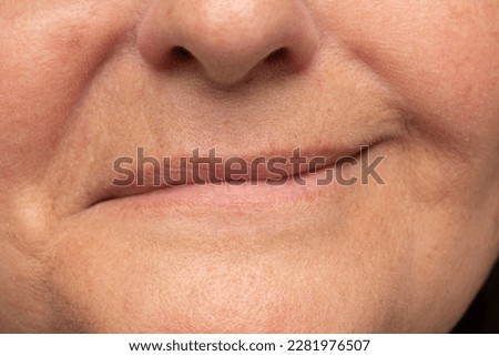 Close-up of a woman's mouth smiling. Evident asymmetry of the lips due to a hemiparesis of the face. Case of Bell's palsy caused by inflammation of the facial nerve. Paresis from cold snap [[stock_photo]] © 