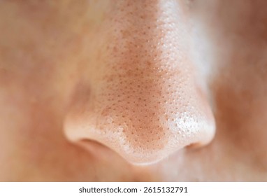 Close-up of a woman's nose with blackheads or black dots. Cosmetology dermatology concept.
