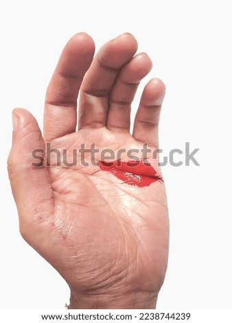 Close-up of wounds are cut with a knife or a sharp object on the skin of the human and blood is red cut on skin. isolated on white background,  medical emergency treatment concept, 2 Dec 2022 india