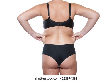 Closeup Wrinkles  Body  Woman, Wrinkles At The Waist. Fat Woman In Underwear Back. Female Waist. Body Women After Childbirth, Excess Fat Woman. Wrinkles On His  Stomach. Isolated On White Background  