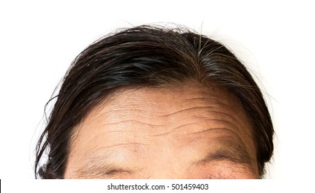 Closeup Wrinkles On Forehead Old Woman