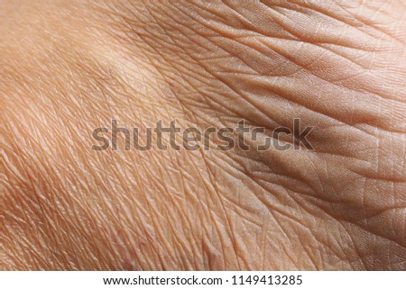 Closeup of wrinkles skin in deep layers. Skin repair and treatment concept for elderly and aged people. Healthcare, medical and aesthetic concept