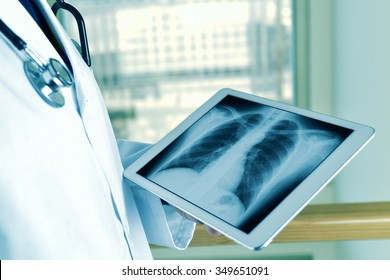 Radiographie Images Stock Photos Vectors Shutterstock