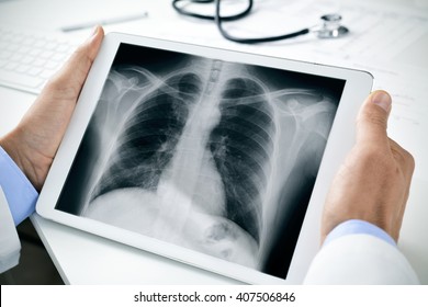 closeup of a young caucasian doctor man sitting at his office desk observing a chest radiograph in a tablet computer - Powered by Shutterstock