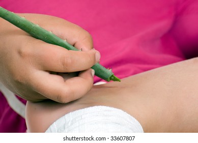 Closeup Of A Young Girl Applying Some Pure Aloe Vera To Help Ease The Itchiness Of A Mosquito Bite