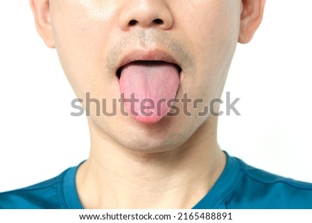 Close-up of a young man. He sticks his tongue out of his mouth to show his tongue. health and medical concepts